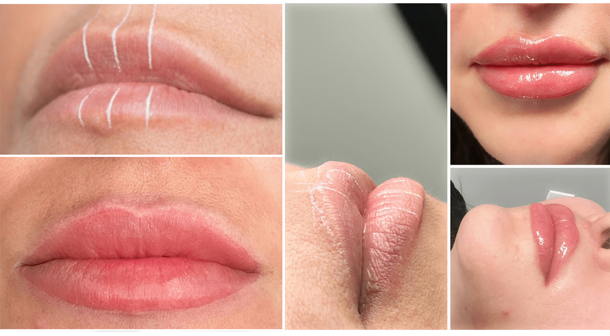 Stunning before and after transformation of permanent lip tinting at Lip Doctor showing vibrant, natural-looking color enhancement.