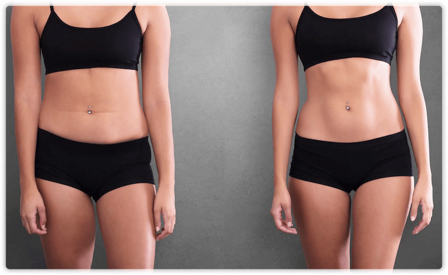 Non-Surgical Makeover in NYC  Vitamineral Body Sculpting and Contouring