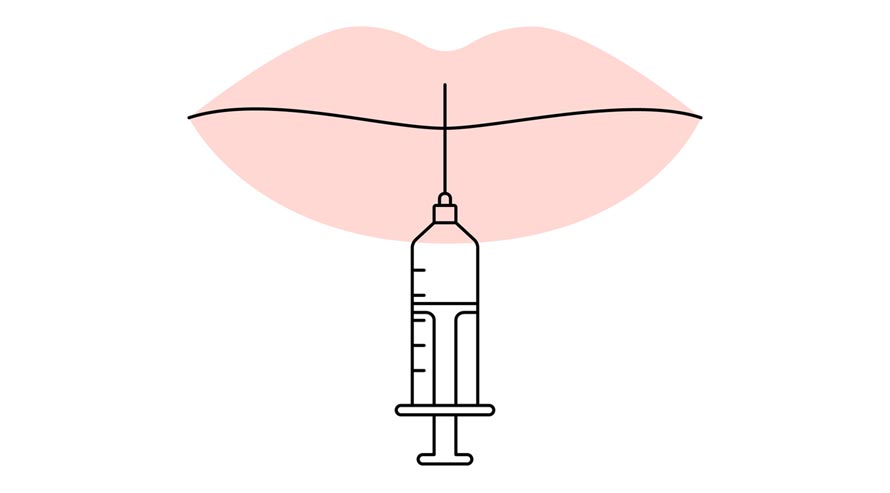 Lip Fillers