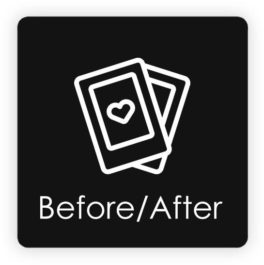 Before and After