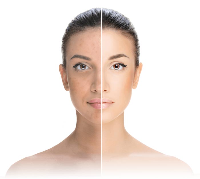 Virtual Cosmetic Makeover
