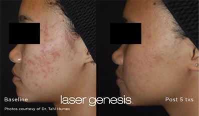 Advanced Facials
