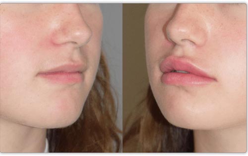 Before and after