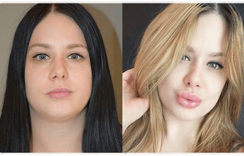 Before and After