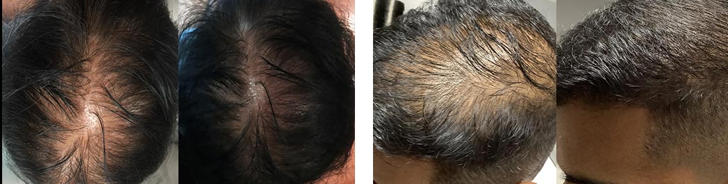 Before and After