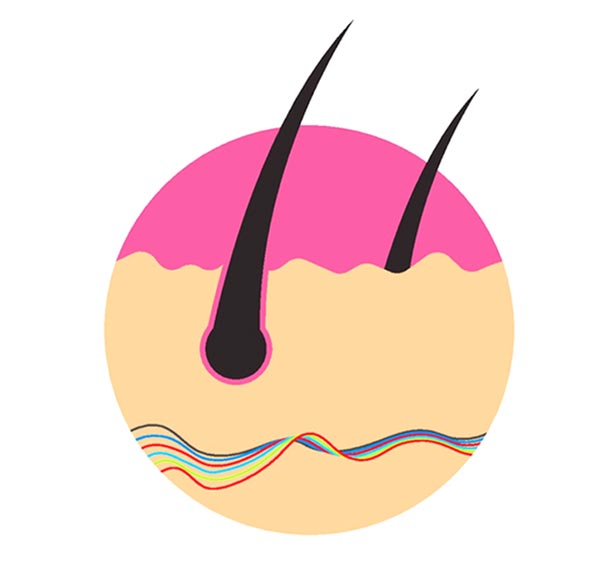 Mesotherapy