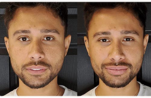 Natural Process