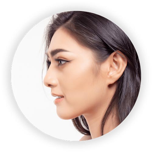 Nose job, Blog