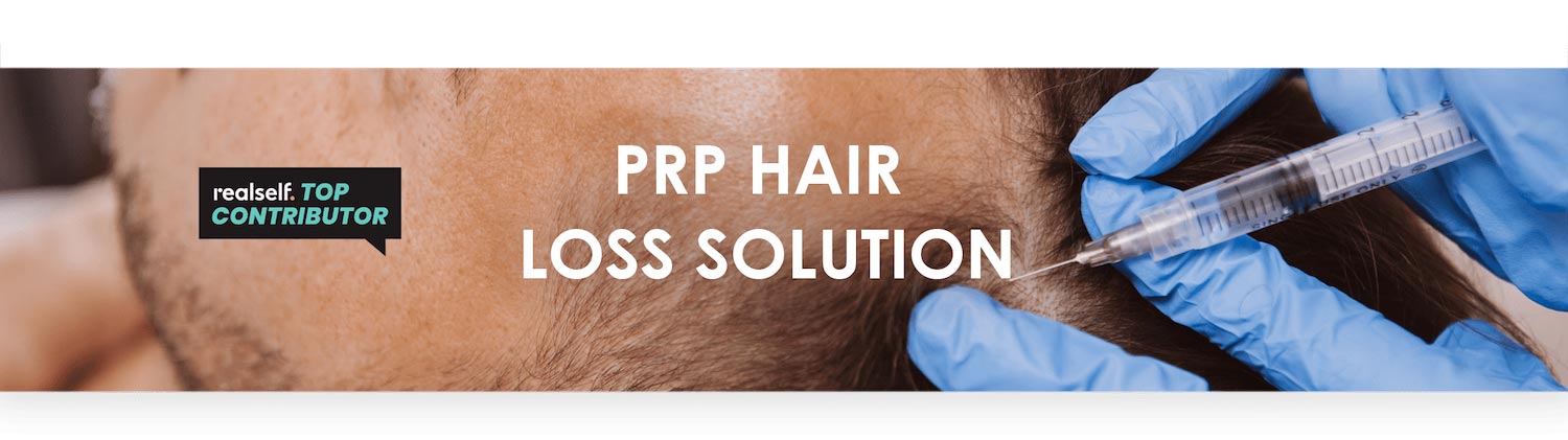 PRP Hair Loss