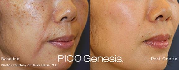 Advanced Facials