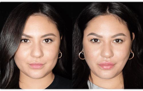 Before and after