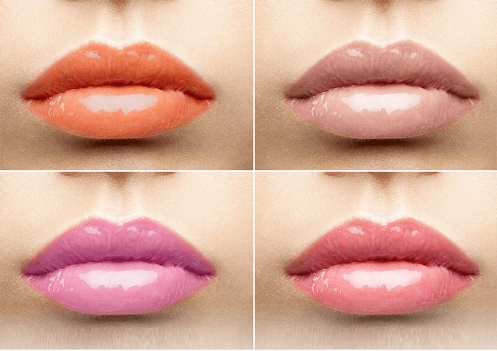 Lip Fillers