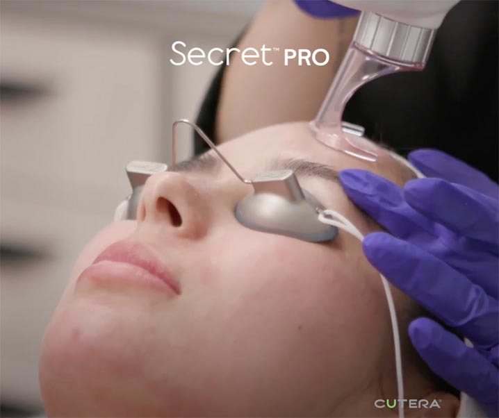 Secret Pro CO2
