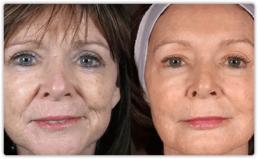 Cosmetic Services
