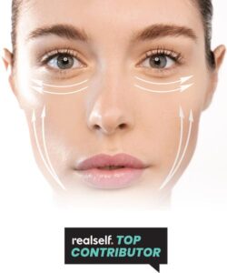 Thread Lifts: Jowl Lift - Lip Doctor | Non-Surgical Treatment