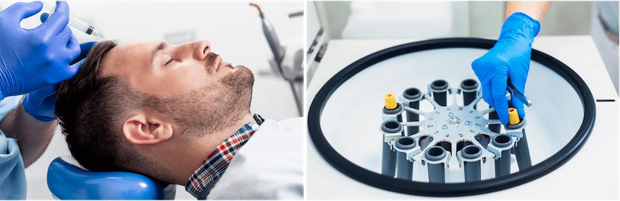 Why PRP, PRP Treatments