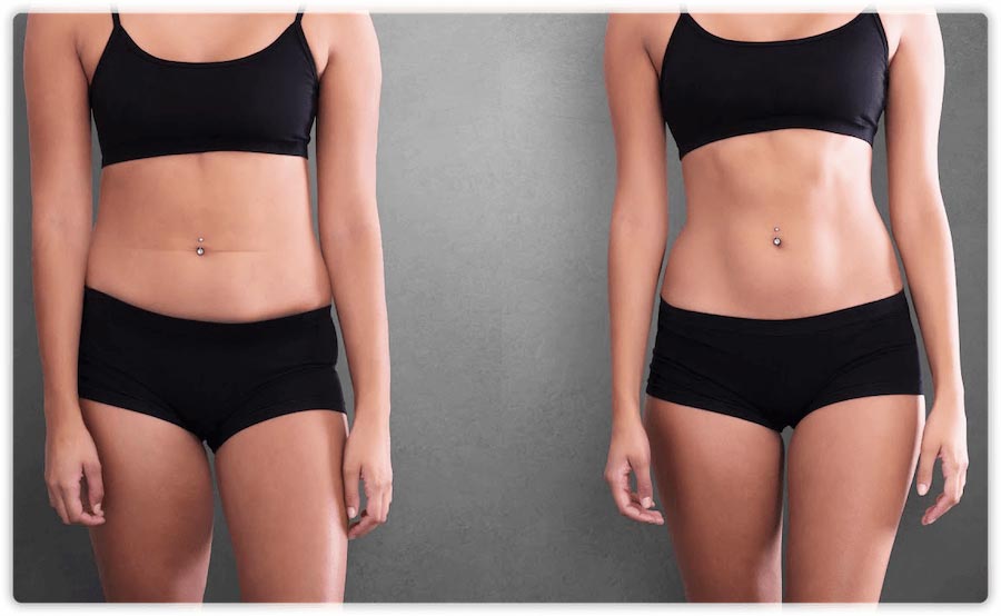 ELIMINATING BODY FAT