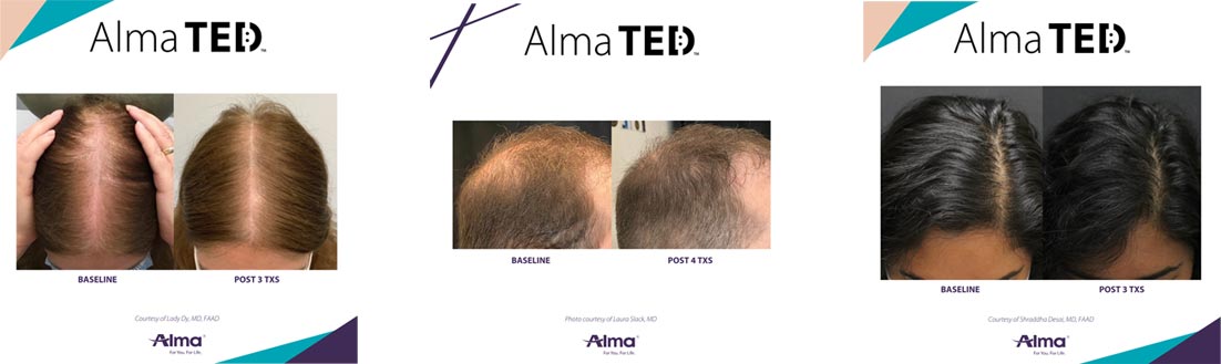 Before and After Treatments