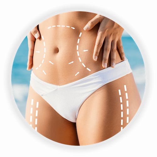 Body Contouring