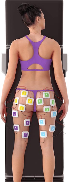 truSculpt® flex