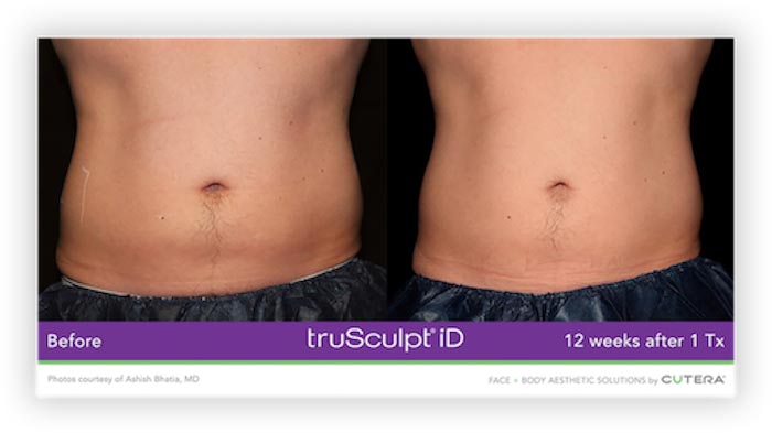 Before and After Treatment
