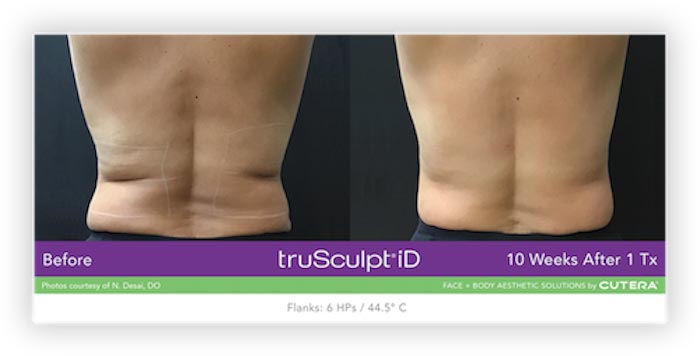 Before and after Treatment