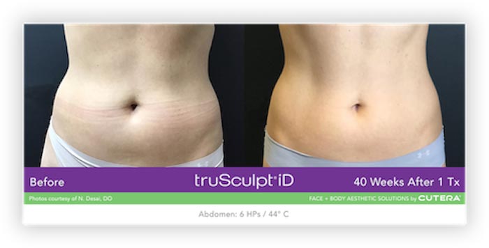 Before and After Treatment