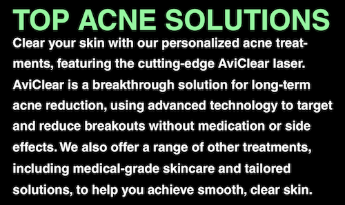 Acne–Treatments–AviClear–Lasers–Mississauga–Oakville