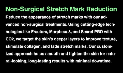 Non-Surgical Stretch Mark Reduction with Advanced Technology