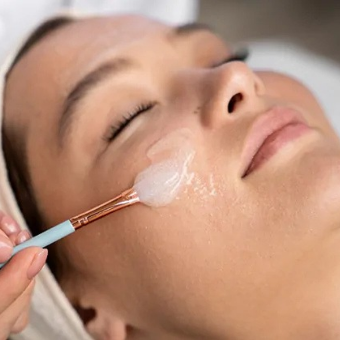 Chemical Peel