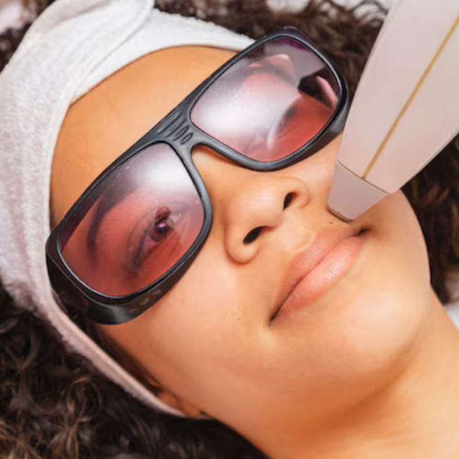 Laser Hair Removal Upper Lip